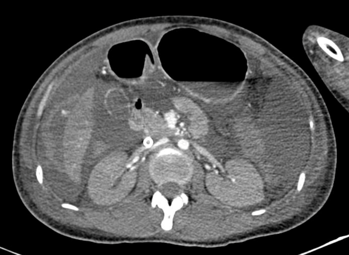 Bệnh viện Nhân dân 115