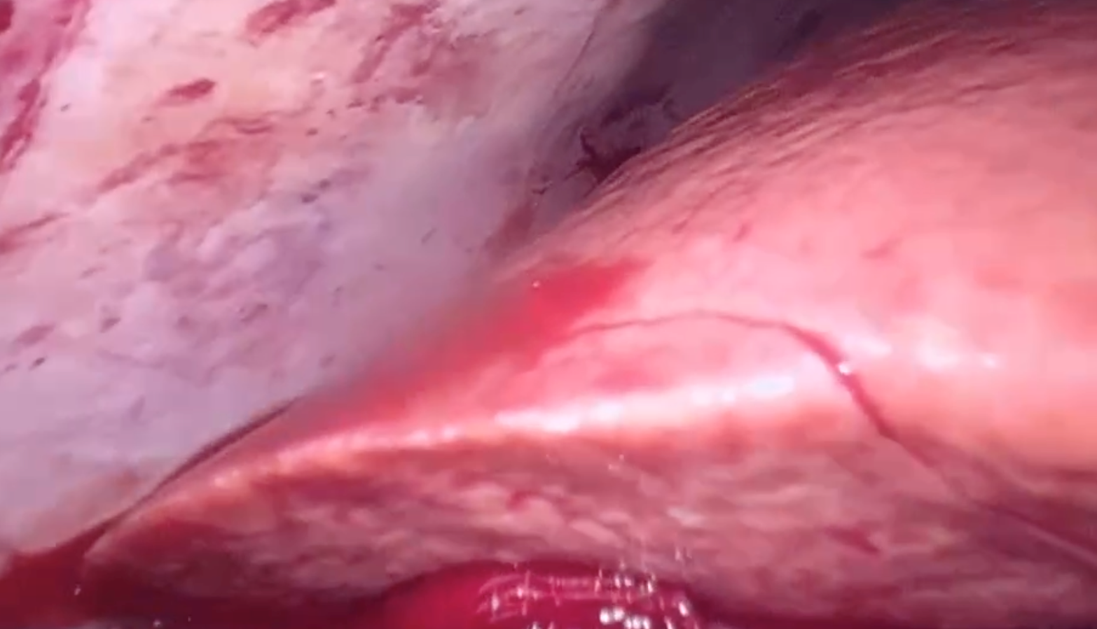 Bệnh viện Nhân dân 115